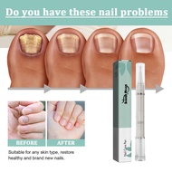 nail kuku ubat kuku rosak repair serum kuku cekam vitamin kuku nail fungus treatment ubat kulat kuku