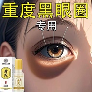 Remove Serious Dark Circles Circles Chlorophyll Remove Eye Bags Eye Cream Dark Circles Fat Granules 