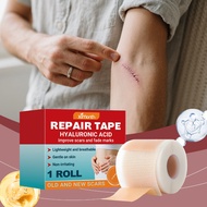 Ximonth Silicone Scar Tape Silicone Scar Sheet Keloid Acne Scar Remover Scar Silicone Sheet Scar Pat