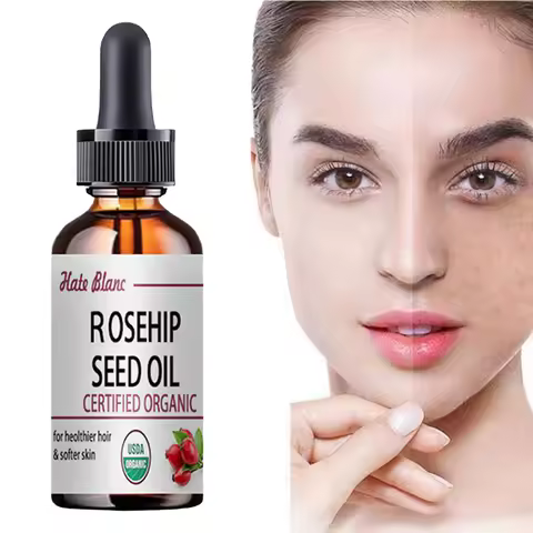 Moisturizing Rosehip Oil Oil Massage Skin Care Plant Essential Oil Moisturizing Whitening Essential 
