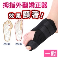 其他品牌 - 【1對】大拇指外翻矯正器 成人護理腳骨 可穿鞋 拇外翻分趾器 [男女適合] 復康用品