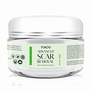 YJKOO Advanced Scar Removal Cream Face & Body With Natural Herbal Extracts Formula 30 ml (1 Count)