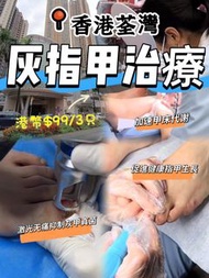 灰指甲