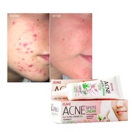 ISME Acne Spots Cream祛痘膏