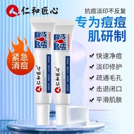 Renhe Salicylic Acid Acne Removal Cream Reduce Acne Marks Repair Acne Marks Acne Marks Acne Gentle S