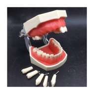 Dental implant model, teeth model with pathologies, removable dental model