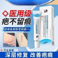 Correction Scar Cream To Remove Scars Repair Scars Childrens Burns And Proliferation Silicone Gel as
