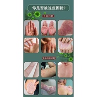 Bai Yao Lang Cream Original Krim Ubat Kurap Gatal Kulit Herba Cina Eczema Anti fungal Cream 白药郎