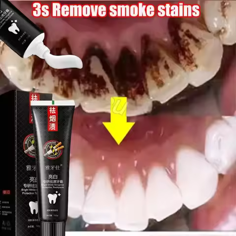 Fast Remove Smoke Stains Toothpaste Teeth Whitening Strips Remove Plaque Stains Oral Hygiene Cleanin