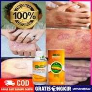 Obat Kusta - Lepra - Kusta Kering/Basah - Obat Luka Kusta - 100% Herbal Qnc Jelly Gamat
