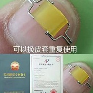 甲溝炎嵌甲矯正器正甲貼正甲扣指甲矯正器甲溝炎矯正貼片指甲矯正