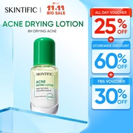 [NEW LAUNCH] SKINTIFIC Acne Drying Lotion Salicylic Acid Acne spot treatmen Acne Scar Serum Essence