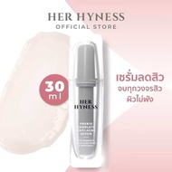 เซรั่มสูตรสำหรับคนเป็นสิว💥HER HYNESS - BOGO BUNDLE PREBIO COMPLETE ANTI-ACNE SERUM 30ML