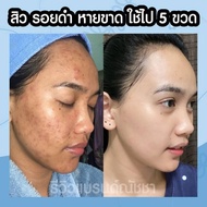 🔥 THAILAND Original 💯 Natcha white serum x10 Hispeed and Natcha