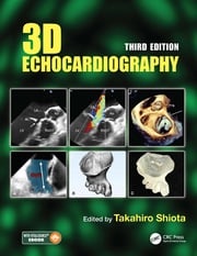 3D Echocardiography Takahiro Shiota