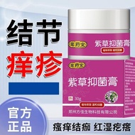 Knotted Itchy Skin Itchy Itchy Itchy Itchy Red Swelling Itchy Cream Adult Universal❈Z11.28