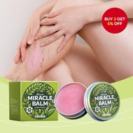 Edema Soothing Remove Varicose Veins Healing Balm Edema Reduces Swelling Soreness Muscle Discomfort 