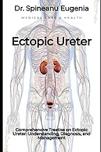 Comprehensive Treatise on Ectopic Ureter: Understanding, Diagnosis, and Management