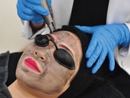 SuperSkin Fatmawati Semarang