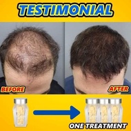 HAIR GROWTH SUPPLEMENT ( 60 biji NO BOX) Hair Loss Problem, Keguguran Rambut 100% Original