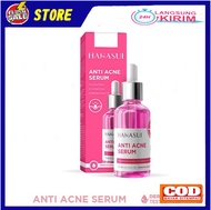 [Kemasan Baru] Hanasui Serum Anti Acne BPOM Hanasui Serum Pink By Jaya Mandiri