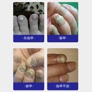 Premium Selection#Sakami Kikawa Impatiens Flower External Use Health Care Solution30ml Soothing Nail