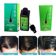 10 Box Original Neo Hair Lotion / Anti-Hair Loss Tonic 120ml x 10 Box SG READY STOCK