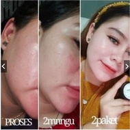 Ay. Paket Platinum Glow Skincare glamor