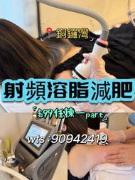 🇭🇰銅鑼灣小店｜射頻溶脂減肥