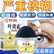 叶黄素明目滴眼液缓眼疲劳视力模糊干涩止痒消炎眼干深度滋润正品Lutein Eye Drops Relieve Eye Fatigue Visual Model20250717