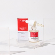 Al Amin Acne Care Serum - Bekas Jerawat