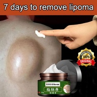 lipoma removal cream lipoma cream 100 % Original Lipoma Removal Cream Special GelLipoma Subcutaneous