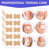 100Pcs Toenail Correction Patch Paronychia Treatment Fungus Removal Nail Entry Correction Sticker Nail Restoration Foot Therapy Tool