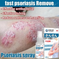 Psoriasis Spray Japan Anti Itchy Anti Fungal Spray Eczema Relief Private Part Antibacterial Cream
