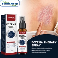 South Moon Eczema Therapy Spray Skin Care Spray Relieve Skin Itching Redness Flaking Irritation Repa