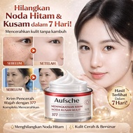 [Best Facial Whitening]|Facial Whitening Cream|377 Black Spot Whitening Cream|Facial Brightening Cre