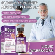 LIQUID WART&CORN REMOVER Penyelesaian Pembuangan Ketuat untuk Ketuat Kemaluan, Ketuat Fokus dan Jagu