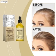 Eelhoe Rosemary Ginger Essential Oil Accelerates Hair Growth Prevents Hair Loss Thinning Hair Nouris