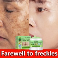 Krim jeragat ubat jeragat klinik krim melasma Freckle cream freckles removal Light spots break down melain blemish 祛斑霜