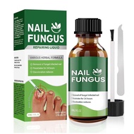 Tnail Fungus Treatment Extra Strength,7Days Nail FungusTreatment for Tnail,7 Pure Natural Plant Extr