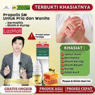 Obat Eksim Kering Dermatitis Salep Dermatitis Obat Dermatitis Seboroik Atopik Gatal Seluruh Tubuh P