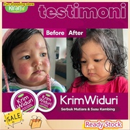 Chandra_SHOP[RECOMMENDED]WIDURI Psoriasis Eczema Cream Antifungal Antibacterial Itchy Ubat Gatal Kur