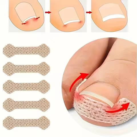 Ingrown Paronychia Toenail Corrector Strips Anti F 10pcs Ingrown Paronychia Toenail Corrector Strips