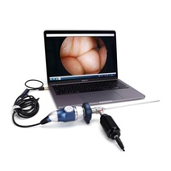 Portable endoscopy gynecology surgery HD USB camera system