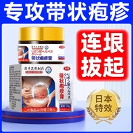Herpes Zoster Berkesan Jepun Balut Ular Pinggang Melegakan Gatal Herpes Zoster Baki Neuralgia Pembua