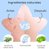 Hydrocolloid Acne Removing Patches With Mirror Box Color Star Acne Pimples Patches 60pcs Q0J4