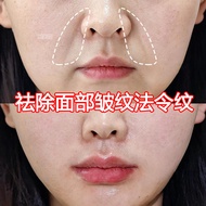 Hexapeptide Anti-Wrinkle Stock Solution Reduce Fine Lines Remove Law Lines Facial Lines Smear Type F
