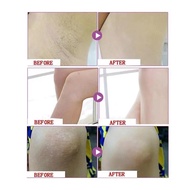 Armpit Whitening Cream Inguinal Bikini Private Parts Butt Underarm Whitening Deodorant Cream