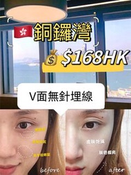 銅鑼灣 V 面無針埋線 $168HK逆齡V面無針埋線，V面緊緻最佳選擇，修飾面型，重塑V型面，改變五官立體感，解決衰老，去除紋路，提拉、溶脂、塑型、緊緻