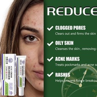 30ml Repair Skin Care Stretch Marks Burn Scar Remover For Body And Face Scar Gel Acne Scar Treatment